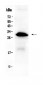 Anti-IGFBP1 Picoband Antibody