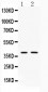 Anti-Doublecortin Picoband Antibody