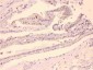 Anti-HDGF Picoband Antibody