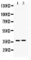 Anti-HDGF Picoband Antibody