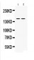 Anti-nNOS(neuronal) Picoband Antibody