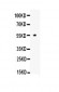 Anti-ANGPTL4 Picoband Antibody