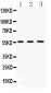 Anti-FGB Picoband Antibody