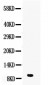 Anti-DBI Picoband Antibody