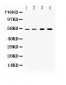 Anti-Cytokeratin 18 Picoband Antibody