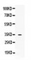 Anti-NAT1 Picoband Antibody