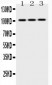 Anti-Hexokinase II Picoband Antibody