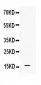 Anti-Iba1 Picoband Antibody