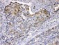 Anti-Cytokeratin 14 Picoband Antibody