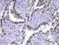 Anti-HnRNP A1 Picoband Antibody