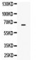 Anti-CPM Picoband Antibody