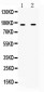 Anti-IFNGR1 Picoband Antibody