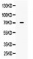 Anti-ALPP Picoband Antibody