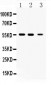 Anti-Beta III Tubulin Picoband Antibody