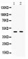 Anti-SERPINA5 Picoband Antibody