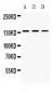 Anti-Nephrin Picoband Antibody