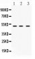 Anti-DR4 Picoband Antibody