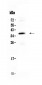 Anti-CORD2 Picoband Antibody