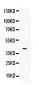 Anti-MC2 receptor Picoband Antibody