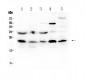 Anti-HSPB8/Hsp22 Picoband Antibody