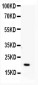 Anti-APRT Picoband Antibody