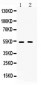 Anti-CHRM2 Picoband Antibody