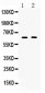 Anti-TUB 1 Picoband Antibody