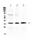 Anti-AKR1B10 Picoband Antibody
