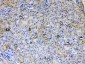 Anti-ALDH1A3 Picoband Antibody
