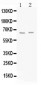 Anti-GAD65 Picoband Antibody