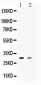 Anti-TSG6 Antibody