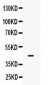 Anti-IRF9 Picoband Antibody