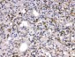 Anti-MMP11 Picoband Antibody