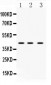 Anti-HnRNP F Picoband Antibody