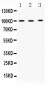 Anti-ADAM2 Picoband Antibody