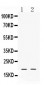 Anti-Alpha Defensin 1 Picoband Antibody