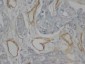 Anti-Collagen, Type IV Antibody (Monoclonal, COL-94)