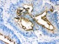 Anti-Episialin, EMA Antibody (Monoclonal, GP1.4)