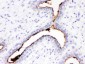 Anti-Episialin, EMA Antibody (Monoclonal, GP1.4)