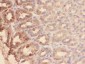 Anti-Mucin Gastric Antibody (Monoclonal, 45M1)