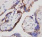 Anti-Beta-HCG Antibody (Monoclonal, PC-2)