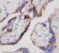 Anti-Beta-HCG Antibody (Monoclonal, PC-2)
