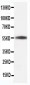 Anti-Beta-Tubulin Antibody (Monoclonal, TUB 2.1)