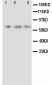 Anti-Angiopoietin-2 Antibody