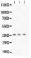 Anti-BDNF Antibody