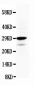 Anti-Calretinin Antibody