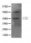 Anti-CCR5 Antibody