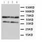Anti-CCR5 Antibody