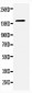 Anti-CD22 Antibody