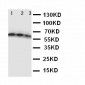 Anti-CD40/TNFRSF5 Antibody